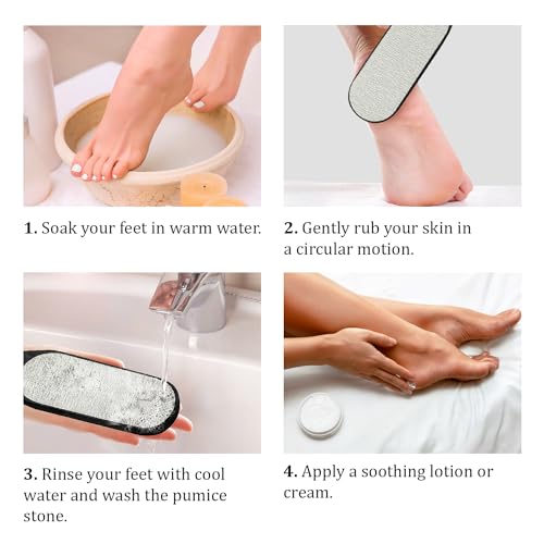 Image of Pumice Stone Foot Scrubber - Pedicure Foot File with Handle for Dry Dead Skin - Callus Remover for Feet - Foot Scraper - Exfoliating Brush for Heels, Elbows, Hands