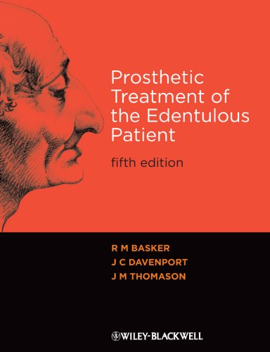 Prosthetic Treatment of the Edentulous Patient Prosthetic Treatment of the Edentulous Patient
