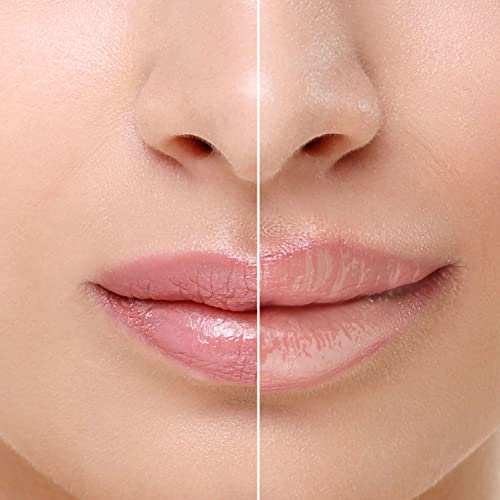 Image of RENEE Natural Glossy Lips Combo| Includes Madness PH Stick 3gm & Tease Lip Plumper 5ml| Soothes & Moisturizes Dry Lips| Non Sticky, Long Lasting Formula with Plumping Effect