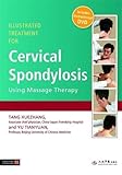  Illustrated Treatment for Cervical Spondylosis Using Massage Therapy