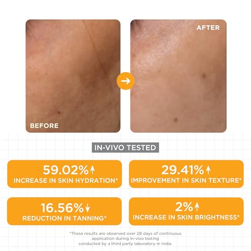 Image of SKINQ 15% Vitamin C Glow Serum with L Ascorbic Acid, Ferulic Acid & Sodium Hyaluronate | Reduces Tan & Brightens Skin | Lightweight, Non-Sticky | For All Skin Types | In-Vivo Tested I Derma Formulated | 15ml