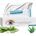 Blepharitis Treatment Eye Cream - Chalazion Eye Treatment - Relief Cream for Eyelids - Soothe Stye, Dry Eyes & Swollen Eyelids - Hydrating Formula for Comfort & Healthy Gentle Care