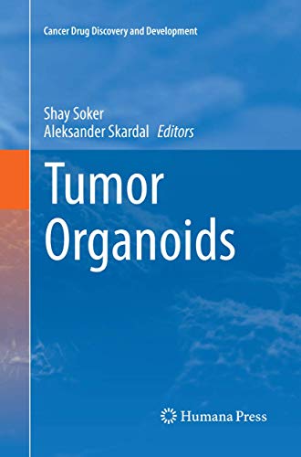 Tumor Organoids (Cancer Drug Discovery and Development)