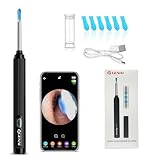 Limpa Ouvidos Visual com Câmera HD, Conector Wi-Fi, Ponta Giratória 360°, Luz LED, para Uso Adulto e Infantil, Branco (Preto)
