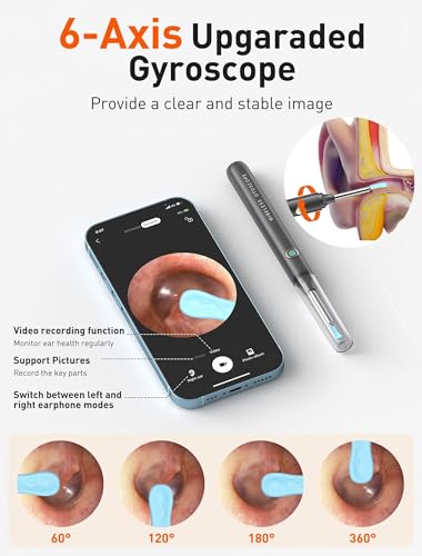 Image of Ear Wax Removal Tool Camera - Ear Cleaner with 1080P HD Camera, FSA HSA Store Eligible, Otoscope with Light, Earwax Removal Kit with Replacement Tips for iPhone, iPad, Android Phones (Gray)