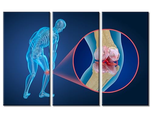 Affiches sur toile de rayons X 3D pour transformer l'ambiance de votre cabinet médical