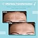 Forehead Wrinkle Patches Reusable | Non-Invasive Wrinkle Treatment for Fine Lines | Works with Face Lift Tape and Eye Patch Kits | Long-Lasting, Gentle Skin Care Solution | Includes Storage Tin