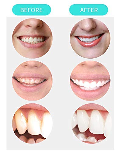 image for Beaueli Activated Charcoal Teeth Whitening Powder (2.1 Oz) Natural Bla