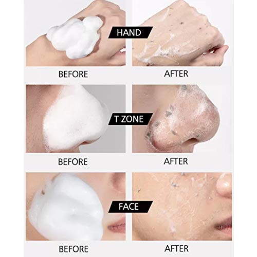 Oil Control Mousse Pore Cleansing Mousse Face Cleansing Mousse Spray Design Exfoliating Mousse For Travel Use For Horniness Fall Off #TOP7