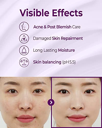[CRAZY SKIN] Skin Repair Trouble Care Sleeping Cream 1.76oz | Deep Moisturizing pH level 5.5 overnight cream | Moisturizer for acne prone skin | Korean skin care | night cream sleeping mask recovery care - Thumbnail 5
