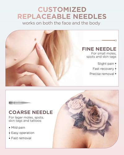 Image of Skin Tag Remover - Skin Tag and Mole Remover for Home Use, Portable Removal Kit for Mole, Wart and Skin Tag for Women and Girls