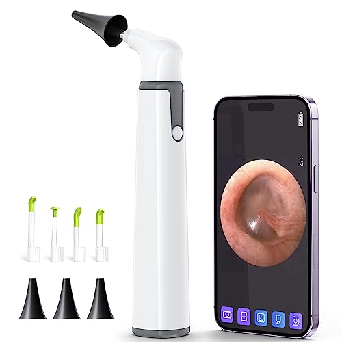 Top 10 Best Digital Otoscope For Iphone Reviews & Buying Guide Katynel