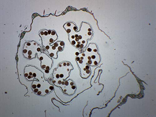 EISCO 10PK Monocot & Dicot Flower Bud - Prepared Microscope Slides - Classroom Pack, 10 Slides in Storage Case - Biology & Microscopy