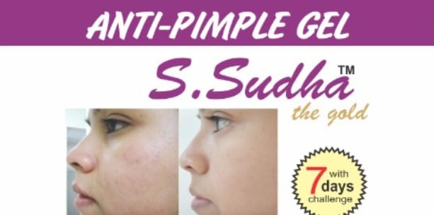 S. Sudha Anti-Pimple Gel for Face, Pack of 1