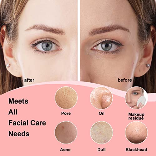 Sonic Facial Cleansing Brush Silicone Face Scrubber, Waterproof Vibrating Face Cleanser Brush, Face Brushes For Cleansing And Exfoliating, Usb Rechargeable #TOP4