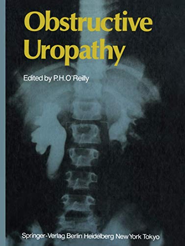 Obstructive Uropathy view 2