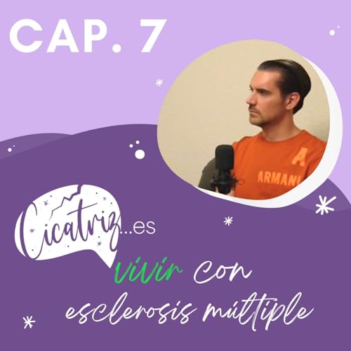 Ep.7 &ndash; Cicatriz...es vivir con esclerosis multiple