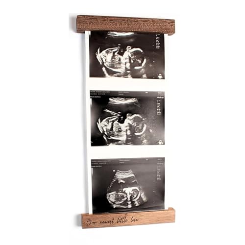 Oscar Bee Sonogram Photo Frame | Ultrasound Keepsake for Baby | Ideal Pregnancy Announcement | Magnetic Picture Frame for Refrigerator | Walnut Finish | Ultrasound Picture Frame | Baby Reveal Gift