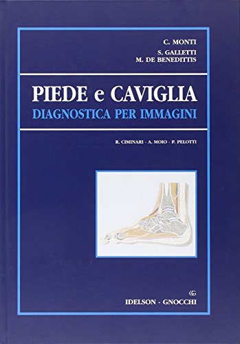 Piede E Caviglia. Diagnostica Per Immagini