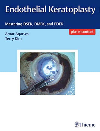 Endothelial Keratoplasty: Mastering DSEK, DMEK, and PDEK