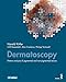 Dermatoscopy: Pattern analysis of pigmented and non-pigmented lesions