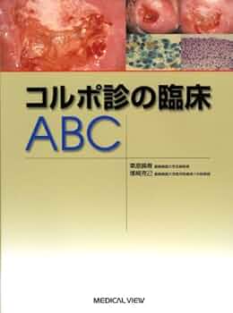 コルポ診の臨床ABC | 栗原 操寿, 塚崎 克己 |本 | 通販 | Amazon