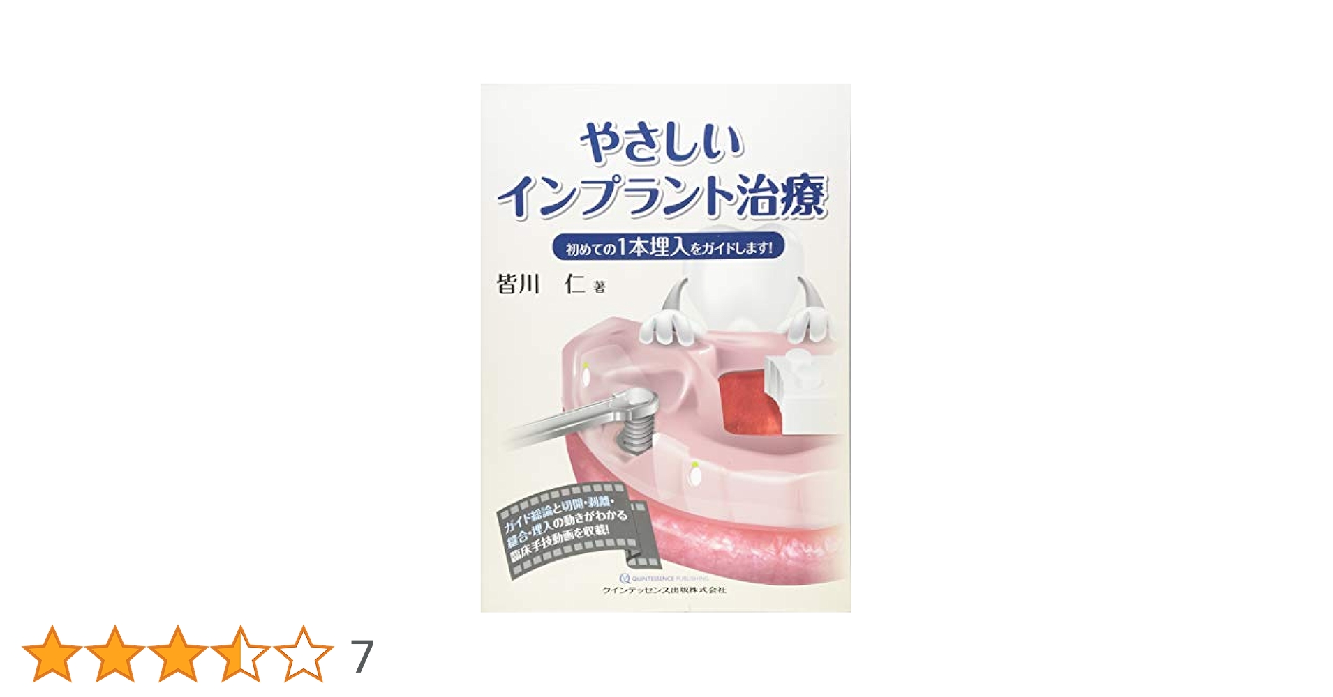 やさしいインプラント治療 | 皆川 仁 |本 | 通販 | Amazon