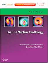 Atlas of Nuclear Cardiology: Imaging Companion to Braunwald's Heart Disease E-Book: Expert Consult - Online and Print (Imaging Techniques to Braunwald's Heart Disease)