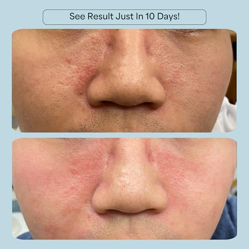 C Revive CelRevive B-Restore™ Barrier Cream soothes, hydrates, and supports microbiome balance, restoring comfort to sensitive, dry skin. EWG Verified™ for safety and transparency. Made in Australia