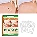 Skin Tag Removal Patches, Muttermal Entfernen, Hydrocolloid Patches, Mole Remover, Haut Tag Entferner Patch, Akne Pimple Patch, Akne Patches, Spot Repair Patches für Gesicht und Pflege,180 Patches