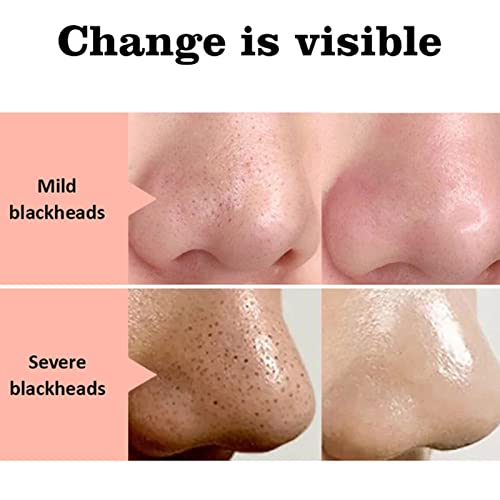 Faixa de nariz cravo | tiras de nariz para remoção de cravos - Tiras de nariz para limpeza profunda,