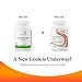 Seeking Health B Complex MF - Vitamin B Complex with Folate, Niacin, & Folinic Acid - Support Energy & Immune System Health with B Vitamins - 100 Capsules