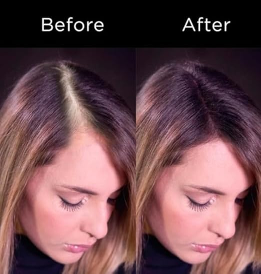 Image of SKINPLUS Hair Building Fibers, Keratin-Derived Fibres For Naturally Thicker Looking Hair, Thick Fiber (Black)