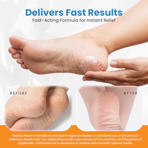 activelife Revitaderm 4D 40% Urea Advanced Foot Cream for Cracked Heels & Dry Skin, Intensive Repair for Rough, Callused Feet, Fast Absorbing, Fragrance Free, Made in USA, 4 oz with Pumice & Brush, 1 Pack