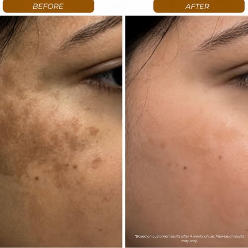 Image of Advanced Vitamin C Brighting Face Serum, 15ml