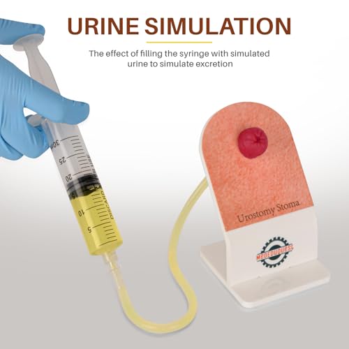 Kit de formation pour stomie : apprenez à éviter les erreurs de soins - 3