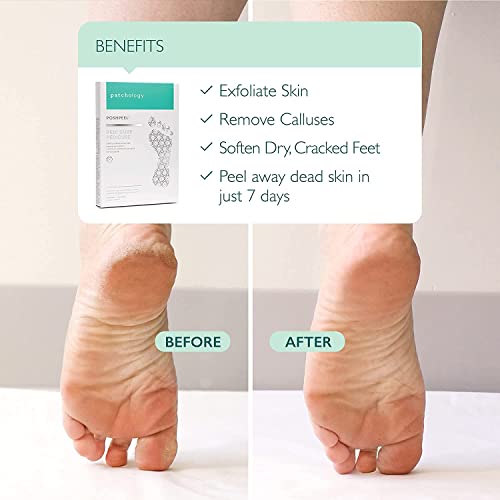 Patchology Poshpeel Pedi Cure - Foot Peel Mask Soak Treatment, Pedicure Foot Spa, Feet Peeling Mask, Pedicure Booties W/Deep Exfoliation For Baby-Soft Skin, Pedicure Supplies For Foot Care, 1 Pair #TOP1