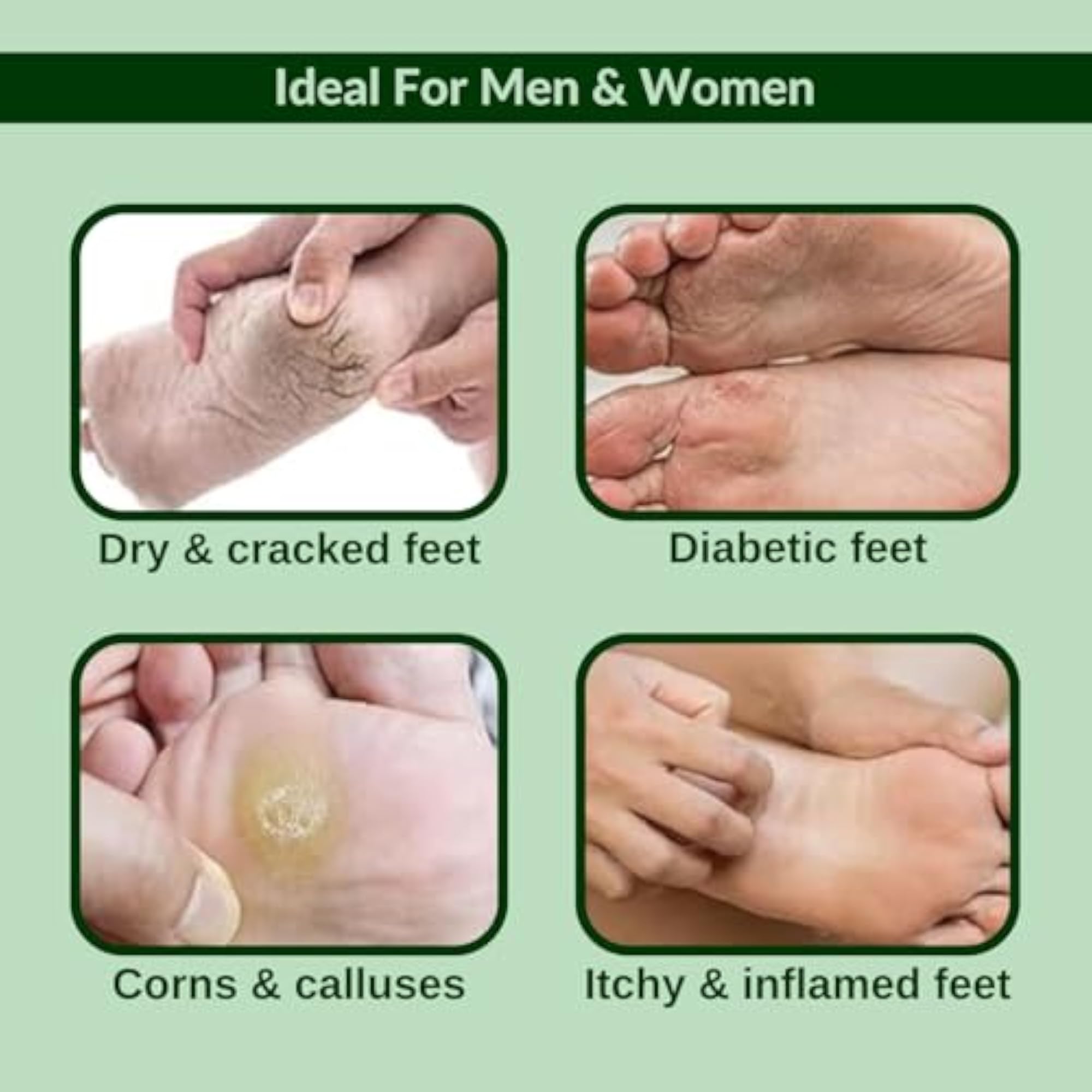 Crack Blaster Heel Repair Cream for Cracked Heels & Dry Feet