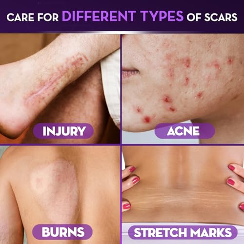 image for Cicatricure Advanced Scar Gel for Face & Body - Proven Results in 2 We