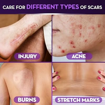 Cicatricure Advanced Scar Gel for Face & Body - Proven Results in 2 Weeks, Scar Treatment for Surgical Scars, Stretch Marks, Scars of Burns and Injuries, Acne Scar Treatment, 1 oz (28 g) - Pack of 2