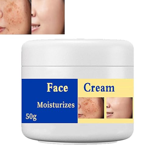 Melasma Treatment for Face,Removes Facial Melasma Dark Spots,Spot Cream Hyperpigmentation Treatment,Sun Spots and Melasma Freckle Remover,Remove Dark Spots,Pigmentation Removal Cream for Face