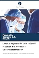 Offene Reposition und interne Fixation bei vorderer Unterkieferfraktur (German Edition) 6200819653 Book Cover