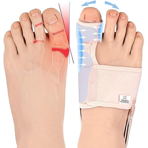 Correcteurs d'oignon PEDIGOO Cover