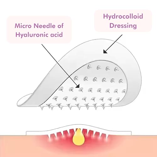 Adesivos Genovie Microneedle para espinhas – Tratamento rápido para acne | Ácido salicílico, ácido h