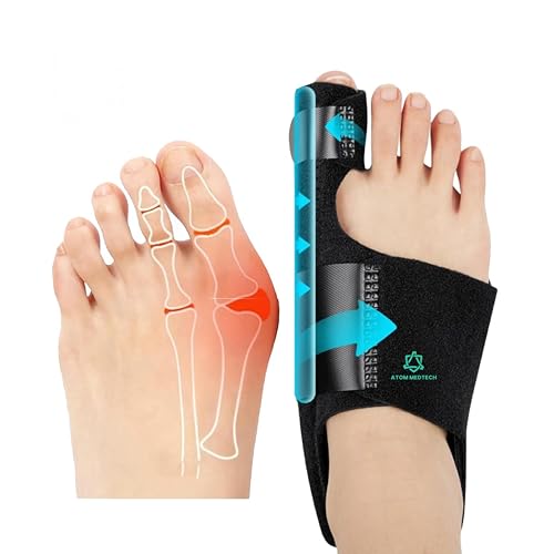 Image of Bunion Corrector for Women and Men| Toe Separator Both 2 Feet Bunion Splint, Big Toes Separation Pain Relief, Non-Surgical Adjustable Hallux Valgus Bunions Thumb Straightener, Hammer Toe Day Night Support (Pack of 1)