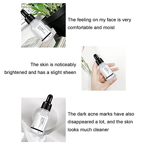 Whitening Essential Oil, Niacinamide Whitening Face Serum, Anti-Aging Serum Repair Skin, Whitening Essential Oil Anti-Aging Serum, Whitening Essential Oil Skin Care, Whitening Essential Oil For Face (1Pc) #TOP3