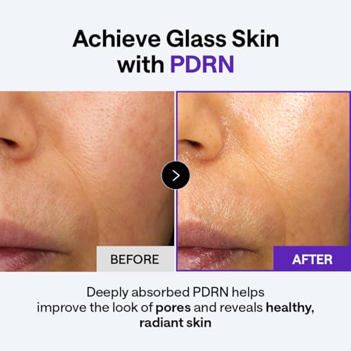 Image of MEDIHEAL Derma Cream [PDRN] - Pore Minimizing Moisturizer with Adenosine, Niacinamide & Ceramide | Clinically Tested Elasticity & Deep Hydration Korean Skincare (1.69 fl oz)