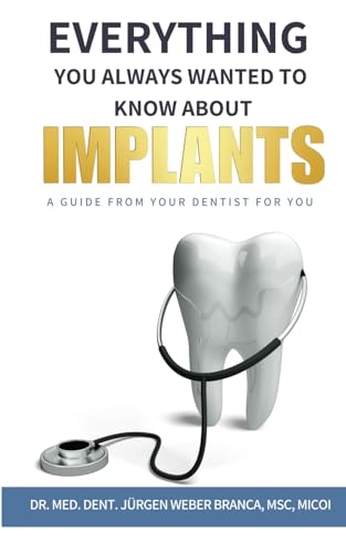 EVERYTHING YOU ALWAYS WANTED TO KNOW ABOUT IMPLANTS: A Guide from Your Dentist for You