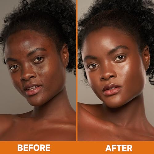 Image of 3P Turmeric Kojic Acid Soap Bars with African Exfoliating Net Sponge, Infused with Retinol, Vitamin E & Shea Butter - For Face & Body, SLS Free, Suitable for Oily & Dry Skin