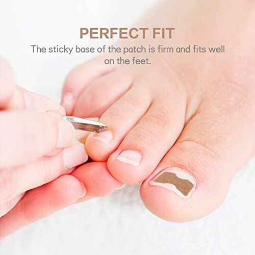 Health Toenail Corrector Patch, Ingrown Toenail Correction Stickers, Elastic Patch Curved Toenails Brace Stickers, Professional Toenail Tool Set, To Relieve Nail Groove (50Pcs) #TOP5